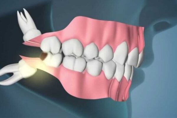 Φρονιμίτες